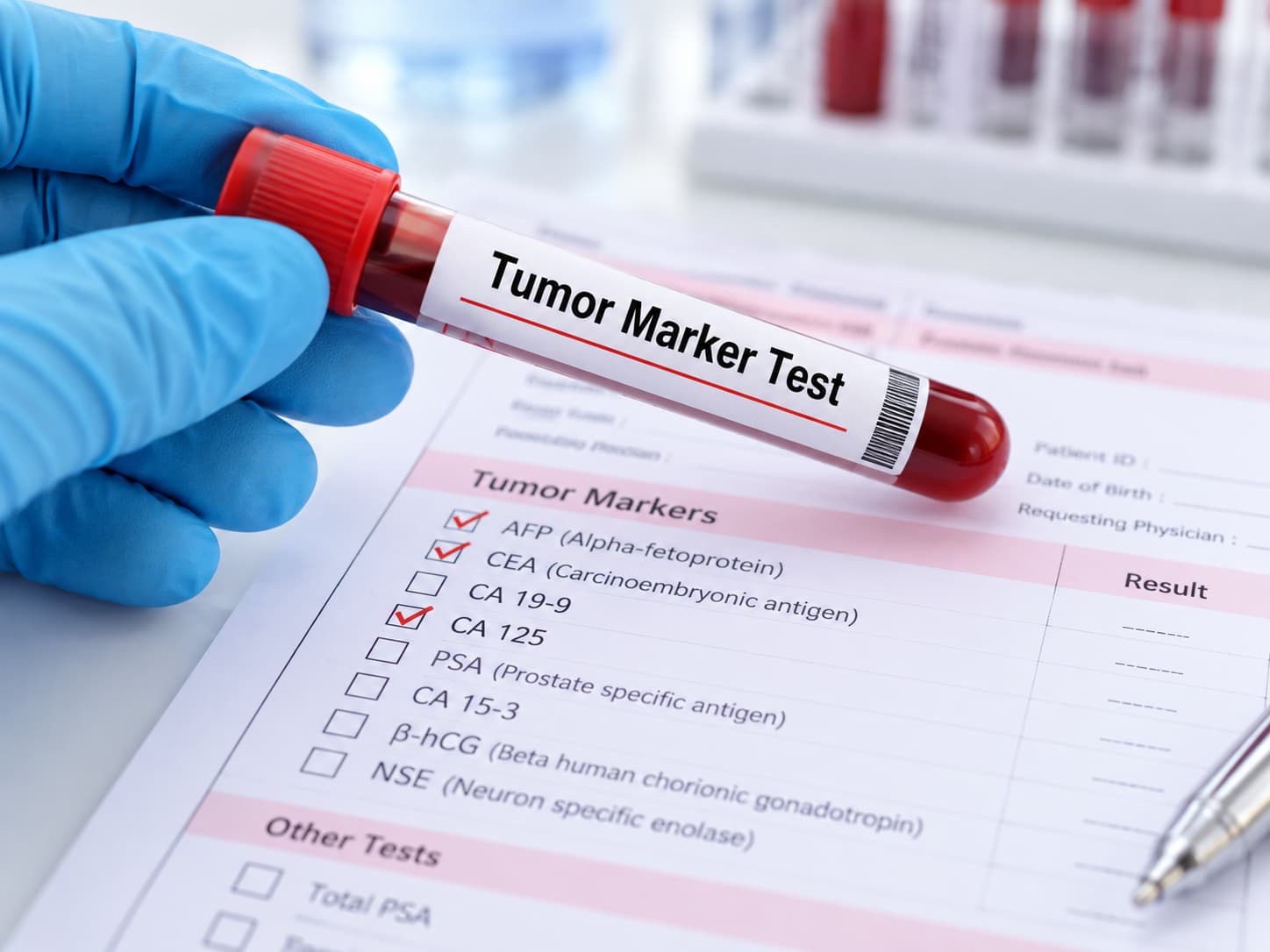 Kanser Marker Testi